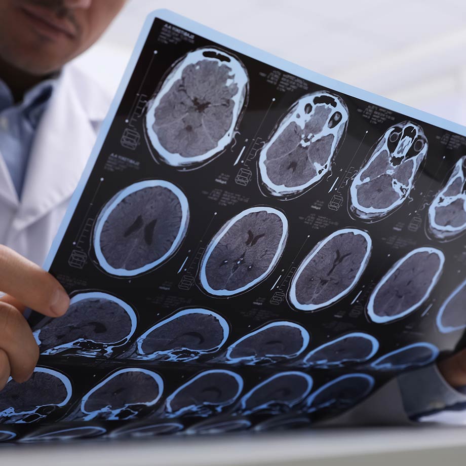 doctor is holding the x-ray images of the brain-small